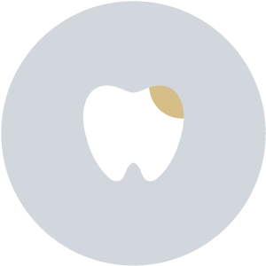 Dental Cavity Treatment