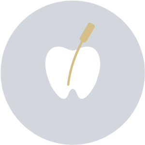 Root Canal Treatment