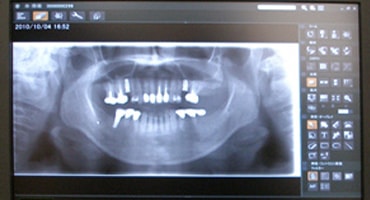 Apparatus to process CT scanner pictures